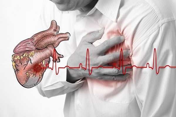 Bệnh đau tim là căn bệnh hàng đầu các bác sĩ khuyến cáo không nên đi máy bay.